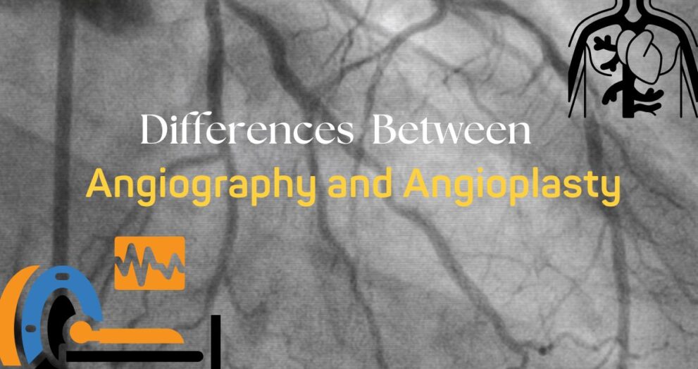 Difference Between Angiography and Angioplasty