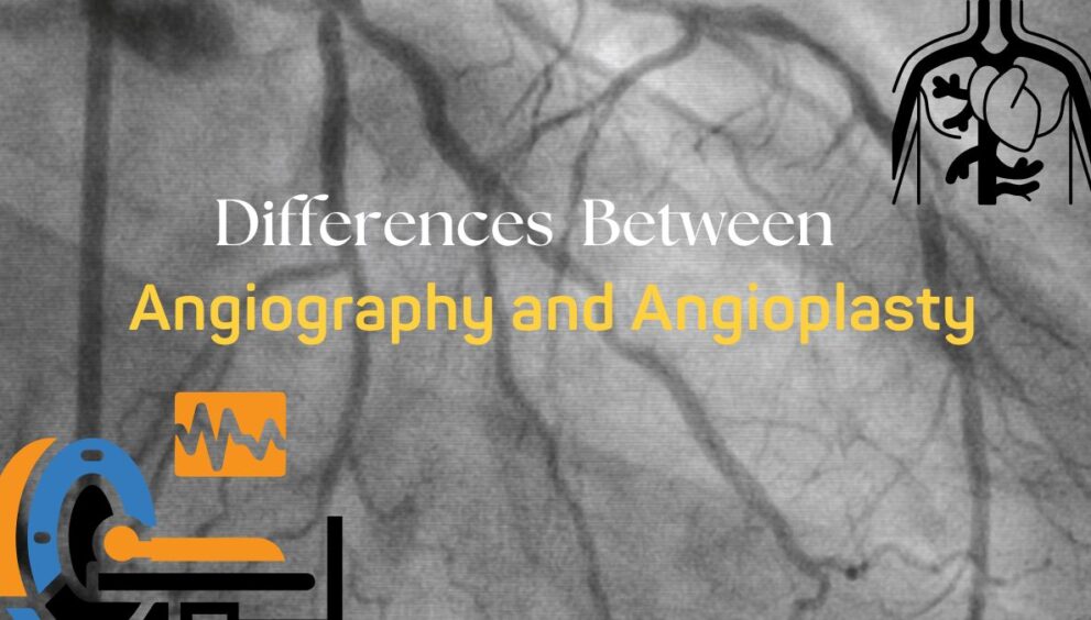 Difference Between Angiography and Angioplasty