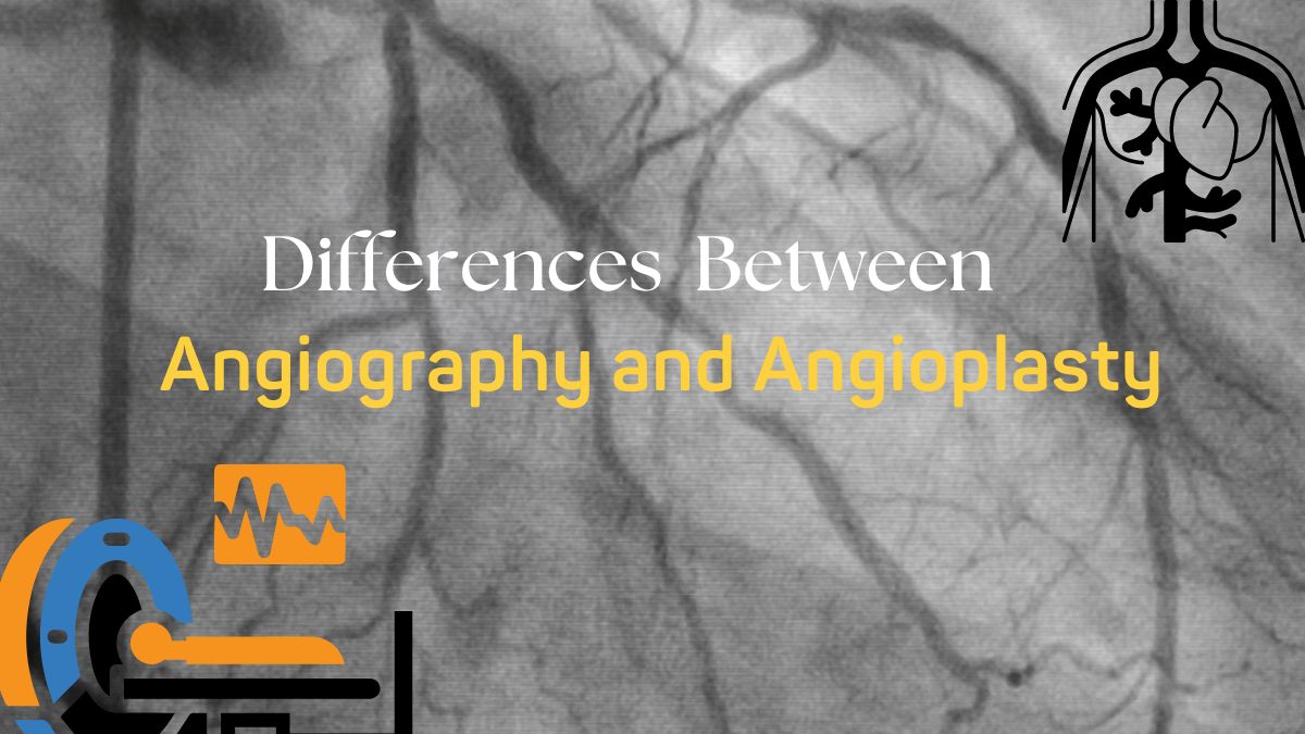 Difference Between Angiography and Angioplasty