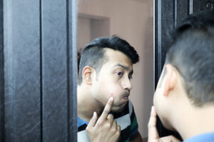 a man squeezing his pimple in his cheek in front of a mirror.