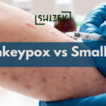 Difference Between SmallPox and MonkeyPox